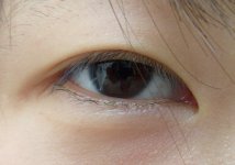 Epicanthic_KR02.jpg