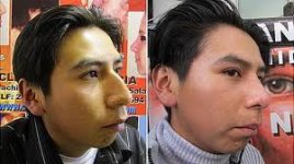nose-jobs_bolivia1.jpg